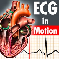 ECGinMotion
