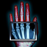 XRayFX