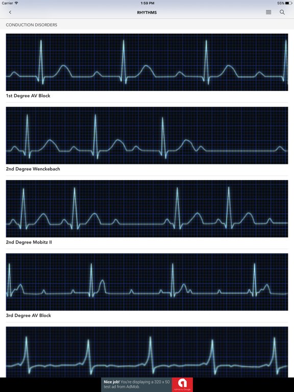 Instant ECG - Mastery of EKG