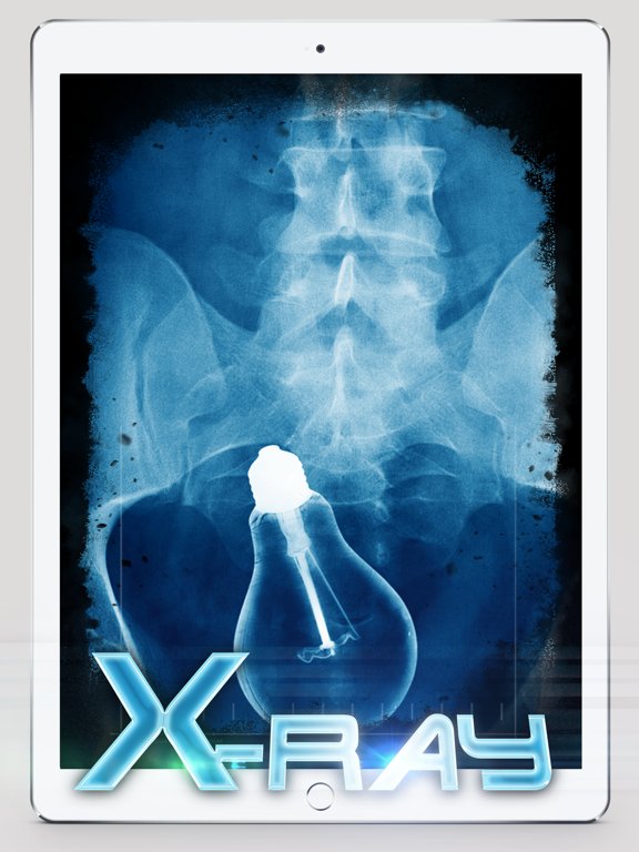 Best X-Ray