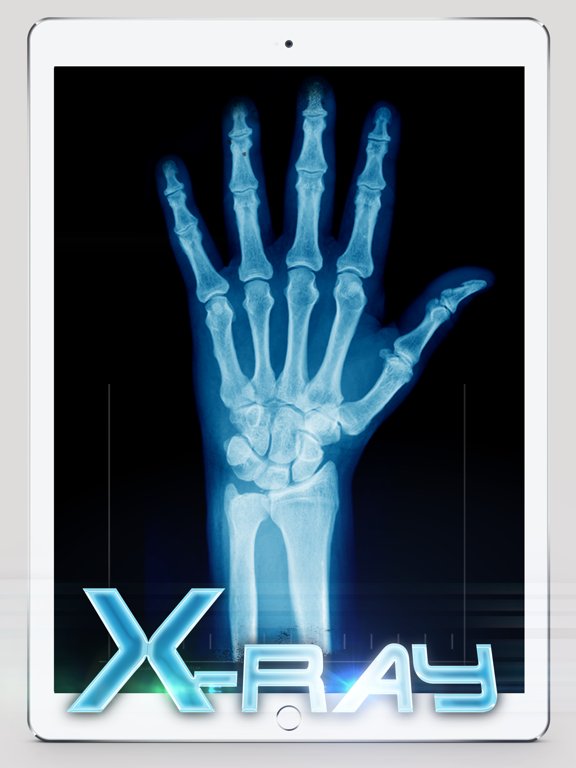 Best X-Ray